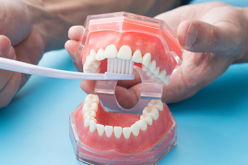 清田区・清田の森歯科・歯周病安定期治療（SPT）とは
